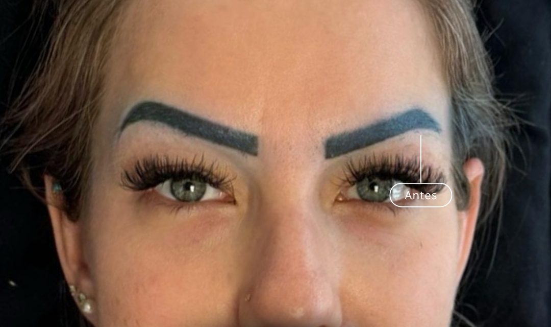 Antes