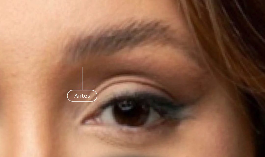 Antes