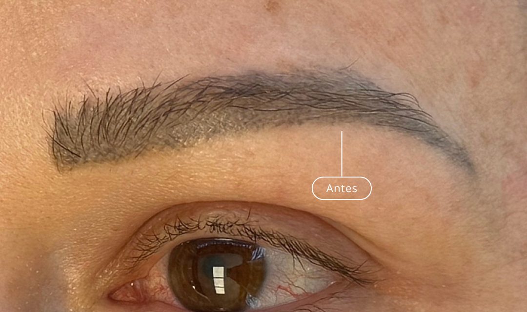 Antes