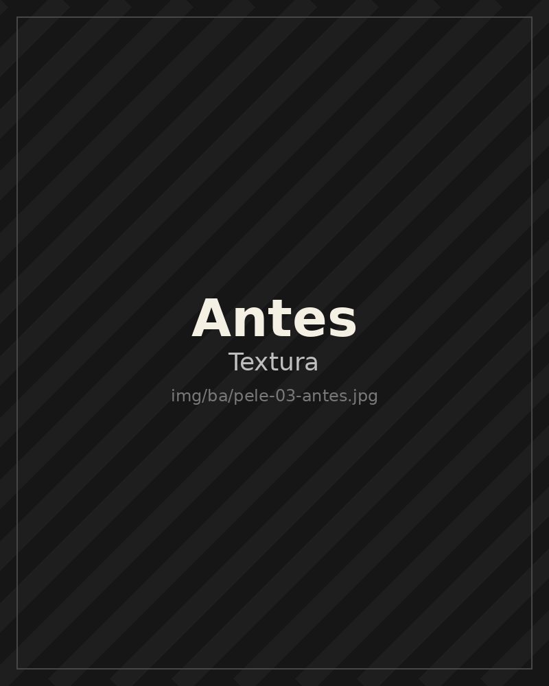 Textura da pele antes do protocolo