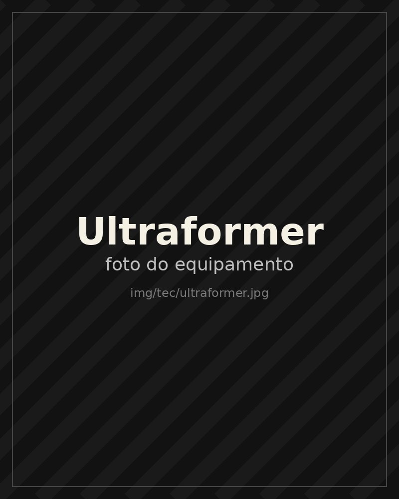 Equipamento Ultraformer na BTZ Med