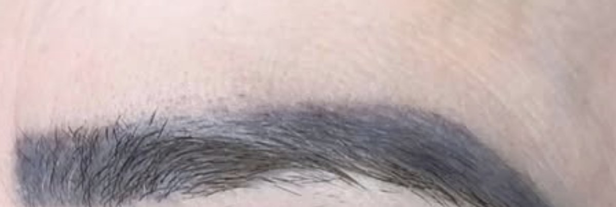 Antes: sobrancelha com micropigmentação escura e desenho marcado